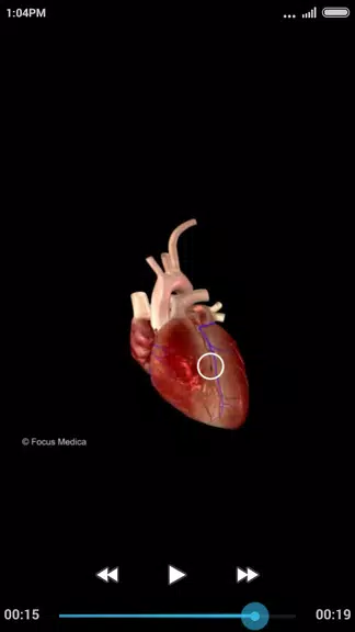 Cardiology-Animated Dictionary應用截圖第2張
