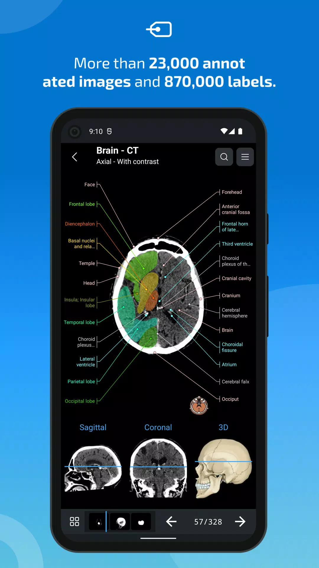 e-Anatomy ภาพหน้าจอ 1