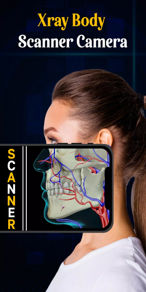 X Ray Mobile v.2.0應用截圖第1張