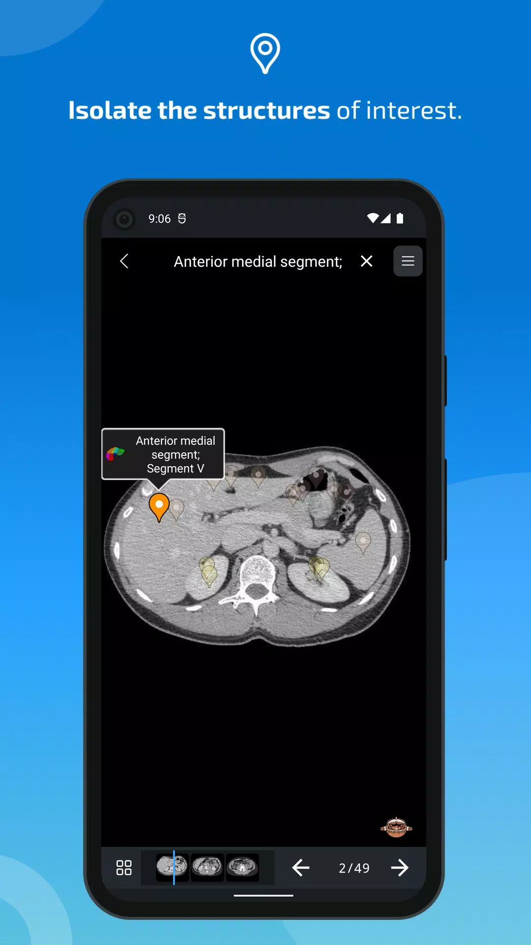 e-Anatomy ภาพหน้าจอ 3